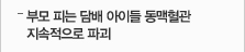 부모 피는 담배 아이들 동맥혈관 지속적으로 파괴