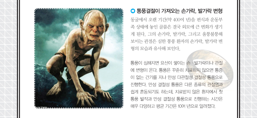 통풍결절이 가져오는 손가락 발가락 변형