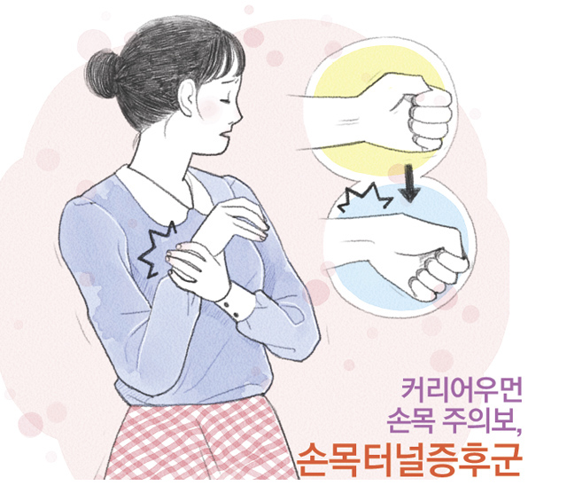 커리어우먼 손목 주의보, 손목터널증후군