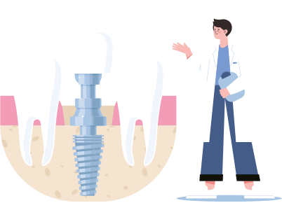 임플란트 시술에 대해 설명하는 의료진의 모습을 그린 일러스트 이미지